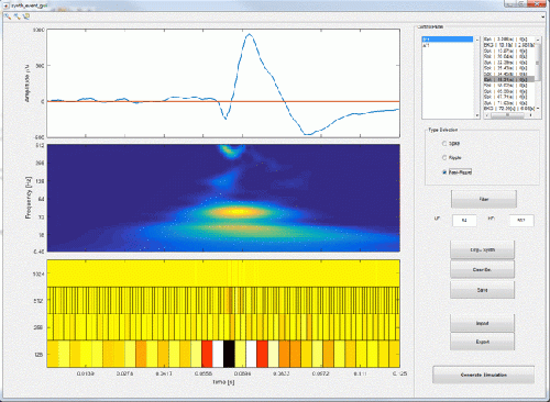 Animated extraction of a fast-ripple in SEEG recording
